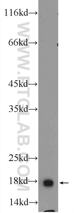 ACP1 Rabbit anti-Human, Mouse, Polyclonal, Proteintech 20 &mu;L; Unconjugated:Antibodies,