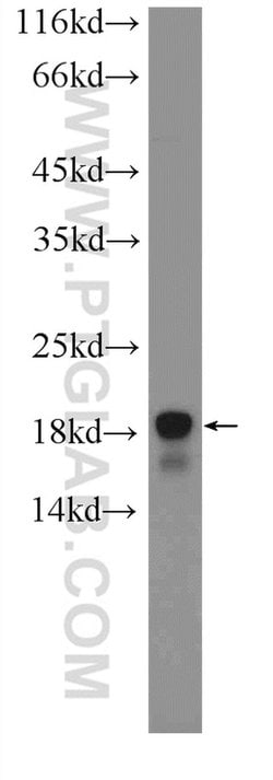 ACP1 Rabbit anti-Human, Mouse, Polyclonal, Proteintech 20 &mu;L; Unconjugated:Antibodies,