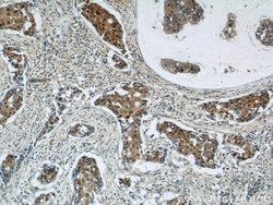 CSE1L Rabbit anti-Human, Mouse, Polyclonal, Proteintech:Antibodies:Primary