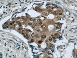 CSE1L Rabbit anti-Human, Mouse, Polyclonal, Proteintech:Antibodies:Primary