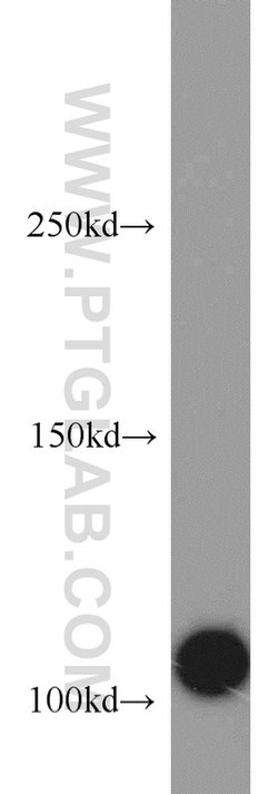 CSE1L Rabbit anti-Human, Mouse, Polyclonal, Proteintech:Antibodies:Primary