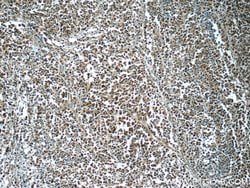 CSE1L Rabbit anti-Human, Mouse, Polyclonal, Proteintech:Antibodies:Primary