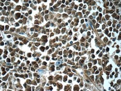 CSE1L Rabbit anti-Human, Mouse, Polyclonal, Proteintech:Antibodies:Primary