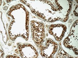 CSE1L Rabbit anti-Human, Mouse, Polyclonal, Proteintech:Antibodies:Primary