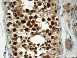 CSE1L Rabbit anti-Human, Mouse, Polyclonal, Proteintech:Antibodies:Primary