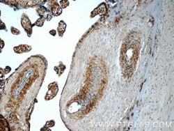 CSE1L Rabbit anti-Human, Mouse, Polyclonal, Proteintech:Antibodies:Primary