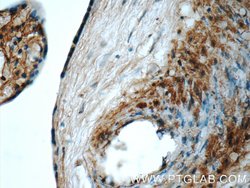 CSE1L Rabbit anti-Human, Mouse, Polyclonal, Proteintech:Antibodies:Primary