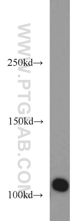 CSE1L Rabbit anti-Human, Mouse, Polyclonal, Proteintech:Antibodies:Primary