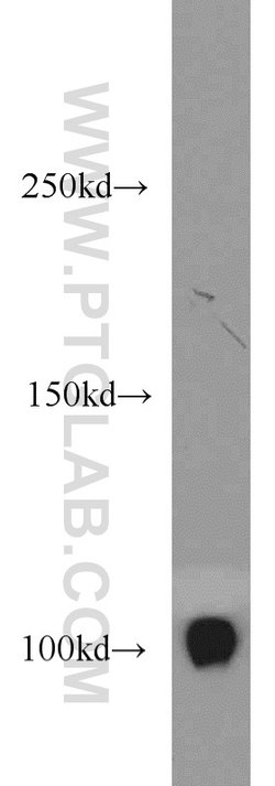 CSE1L Rabbit anti-Human, Mouse, Polyclonal, Proteintech:Antibodies:Primary