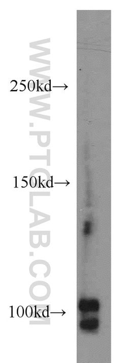 CSE1L Rabbit anti-Human, Mouse, Polyclonal, Proteintech:Antibodies:Primary