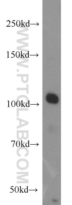 CSE1L Rabbit anti-Human, Mouse, Polyclonal, Proteintech:Antibodies:Primary