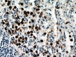MPO Rabbit anti-Human, Polyclonal, Proteintech 150 μL; Unconjugated:Antibodies,