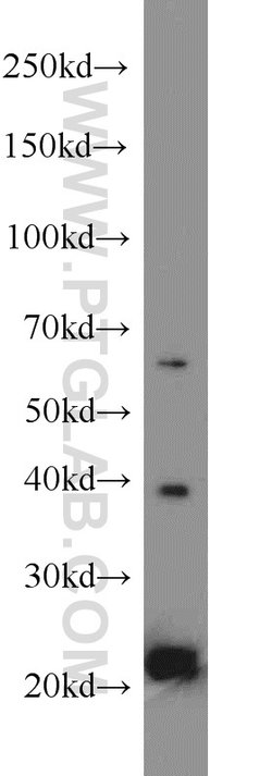 MPO Rabbit anti-Human, Polyclonal, Proteintech 150 μL; Unconjugated:Antibodies,