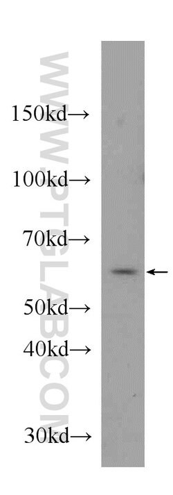 MPO Rabbit anti-Human, Polyclonal, Proteintech 150 μL; Unconjugated:Antibodies,