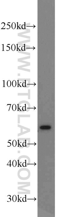 MPO Rabbit anti-Human, Polyclonal, Proteintech 150 μL; Unconjugated:Antibodies,