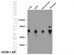 FOXP3 Rabbit anti-Human, Mouse, Rat, Polyclonal, Proteintech:Antibodies:Primary