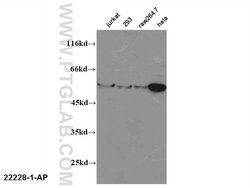 FOXP3 Rabbit anti-Human, Mouse, Rat, Polyclonal, Proteintech:Antibodies:Primary