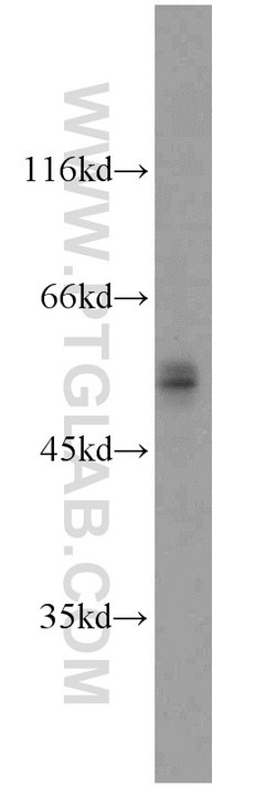 FOXP3 Rabbit anti-Human, Mouse, Rat, Polyclonal, Proteintech:Antibodies:Primary