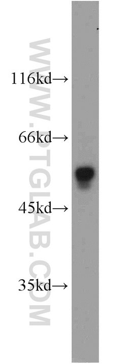 FOXP3 Rabbit anti-Human, Mouse, Rat, Polyclonal, Proteintech:Antibodies:Primary