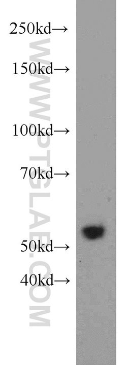 FOXP3 Rabbit anti-Human, Mouse, Rat, Polyclonal, Proteintech:Antibodies:Primary