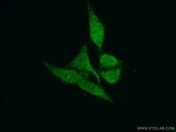 TIMM50 Rabbit anti-Human, Rat, Polyclonal, Proteintech 150 &mu;L; Unconjugated:Antibodies,