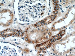 TIMM50 Rabbit anti-Human, Rat, Polyclonal, Proteintech 150 &mu;L; Unconjugated:Antibodies,