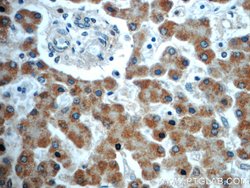 TIMM50 Rabbit anti-Human, Rat, Polyclonal, Proteintech 150 &mu;L; Unconjugated:Antibodies,