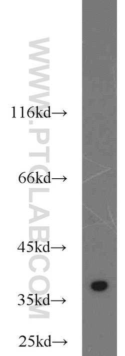 TIMM50 Rabbit anti-Human, Rat, Polyclonal, Proteintech 150 &mu;L; Unconjugated:Antibodies,