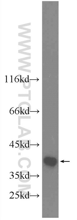 TIMM50 Rabbit anti-Human, Rat, Polyclonal, Proteintech 150 &mu;L; Unconjugated:Antibodies,