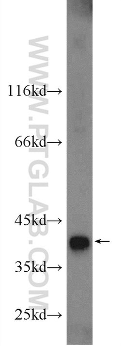 TIMM50 Rabbit anti-Human, Rat, Polyclonal, Proteintech 150 &mu;L; Unconjugated:Antibodies,