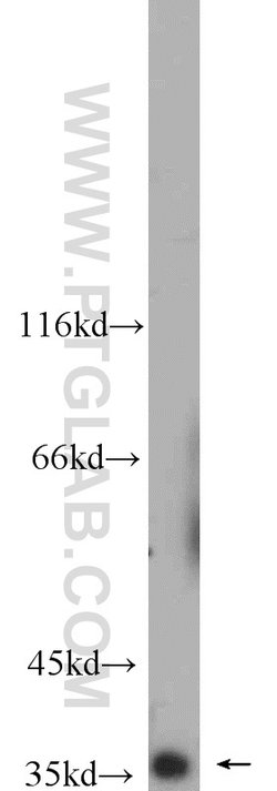 TIMM50 Rabbit anti-Human, Rat, Polyclonal, Proteintech 150 &mu;L; Unconjugated:Antibodies,