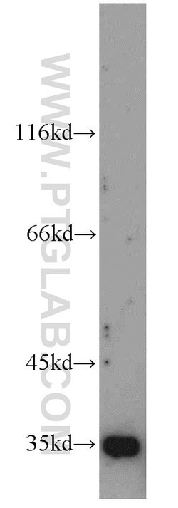 ADAM28 Rabbit anti-Human, Mouse, Polyclonal, Proteintech 150 &mu;L; Unconjugated:Antibodies,
