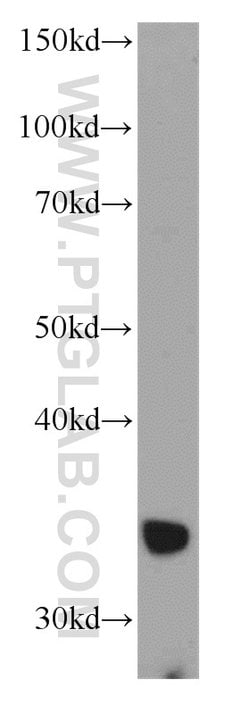 ADAM28 Rabbit anti-Human, Mouse, Polyclonal, Proteintech 150 &mu;L; Unconjugated:Antibodies,