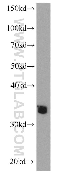 ADAM28 Rabbit anti-Human, Mouse, Polyclonal, Proteintech 150 &mu;L; Unconjugated:Antibodies,