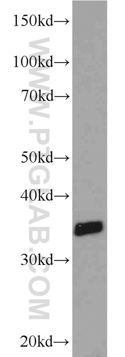 ADAM28 Rabbit anti-Human, Mouse, Polyclonal, Proteintech 150 &mu;L; Unconjugated:Antibodies,