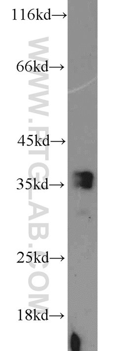 ADAM28 Rabbit anti-Human, Mouse, Polyclonal, Proteintech 150 &mu;L; Unconjugated:Antibodies,