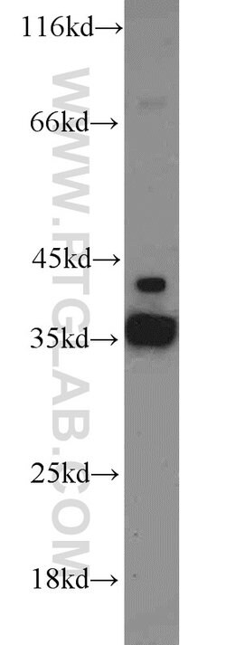 ADAM28 Rabbit anti-Human, Mouse, Polyclonal, Proteintech 150 &mu;L; Unconjugated:Antibodies,