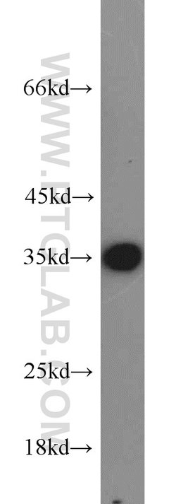 ADAM28 Rabbit anti-Human, Mouse, Polyclonal, Proteintech 150 &mu;L; Unconjugated:Antibodies,