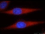 Thumbnail_STK4/MST1 Rabbit anti-Human, Mouse, Rat, Polyclonal, Proteintech 150 &mu;L;