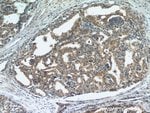Thumbnail_STK4/MST1 Rabbit anti-Human, Mouse, Rat, Polyclonal, Proteintech 150 &mu;L;