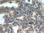 Thumbnail_STK4/MST1 Rabbit anti-Human, Mouse, Rat, Polyclonal, Proteintech 150 &mu;L;