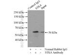 Thumbnail_STK4/MST1 Rabbit anti-Human, Mouse, Rat, Polyclonal, Proteintech 150 &mu;L;
