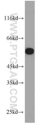 Thumbnail_STK4/MST1 Rabbit anti-Human, Mouse, Rat, Polyclonal, Proteintech 150 &mu;L;