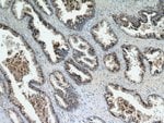 Thumbnail_STK4/MST1 Rabbit anti-Human, Mouse, Rat, Polyclonal, Proteintech 150 &mu;L;