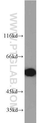 Thumbnail_STK4/MST1 Rabbit anti-Human, Mouse, Rat, Polyclonal, Proteintech 150 &mu;L;