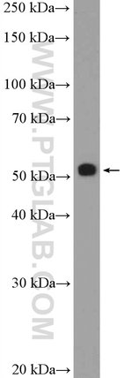 Thumbnail_STK4/MST1 Rabbit anti-Human, Mouse, Rat, Polyclonal, Proteintech 150 &mu;L;