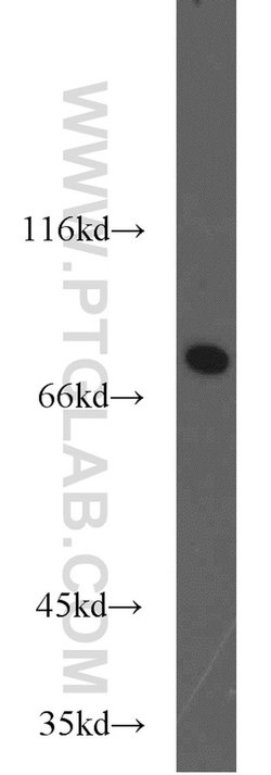ADARB1 Rabbit anti-Human, Rat, Polyclonal, Proteintech:Antibodies:Primary