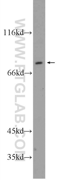 ADARB1 Rabbit anti-Human, Rat, Polyclonal, Proteintech:Antibodies:Primary
