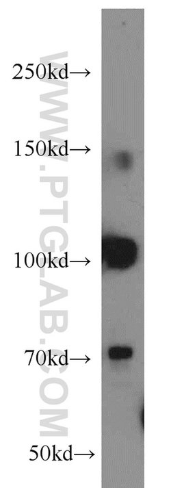 RBM15B Rabbit anti-Human, Mouse, Rat, Polyclonal, Proteintech 150 &mu;L;