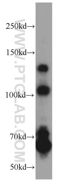 RBM15B Rabbit anti-Human, Mouse, Rat, Polyclonal, Proteintech 150 &mu;L;